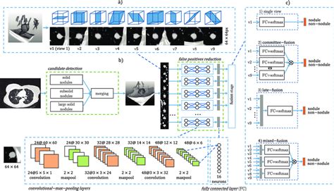 An overview of the proposed CAD system. (a) An example of extracted 2-D ...