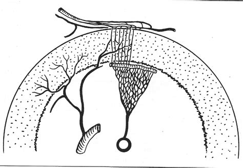 1/3 from the muscles surrounding the diaphysis | Download Scientific Diagram