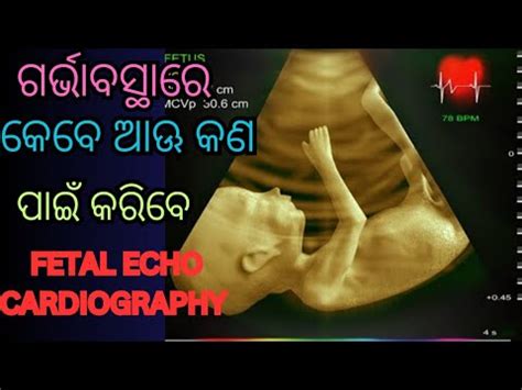 FETAL ECHO CARDIO GRAPHY IN PREGNANCY ଗରଭବସଥର ଶଶ ର HEART ର