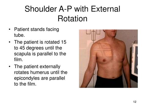 Ppt 141 Shoulder Radiography Powerpoint Presentation Free Download