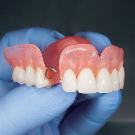 Pr Tesis Sobre Implantes Dentales Qu Son Y Qu Tipos Existen