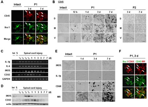 Iba Cd Cells Appear And Express Phagocytic Activity In Injured