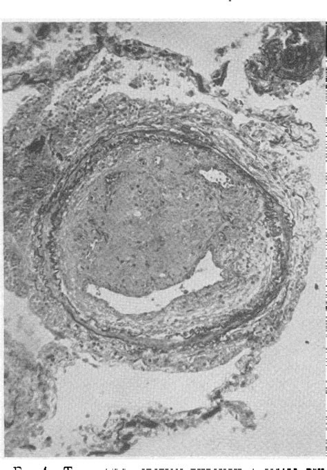 Figure From Pulmonary Diffusing Capacity And Its Subdivisions In