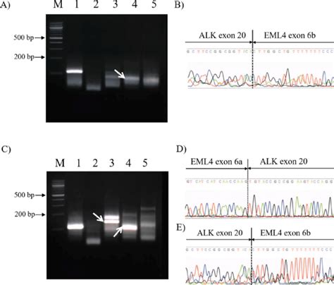 Electrophoresis Of Pcr Product And Sequencing Of Pcr Amplified Dna