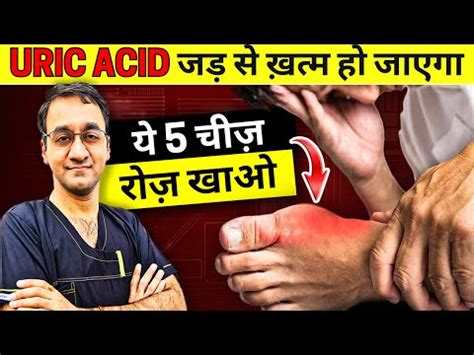 5 Best Foods To Reduce High URIC ACID Uric Acid Home Treatment