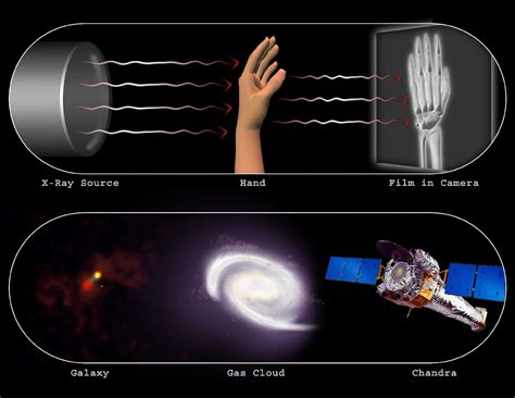 X-Ray Radiation Benefits