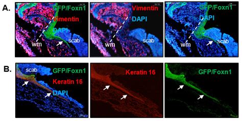 Applied Sciences Free Full Text Foxn1 Control Of Skin Function