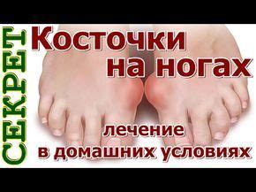 Косточки на ногах лечение | Лечение ног, Лечение, Мудрые цитаты