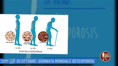 20 Ottobre Giornata Mondiale Osteoporosi Un Giorno Una Storia 20