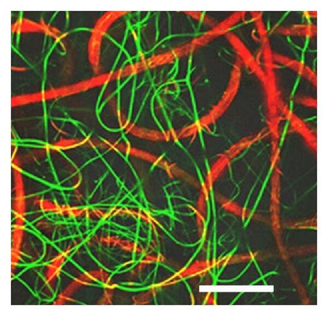 Structure Characterization Of Electrospun Pcl Gel Scaffolds Sem Images