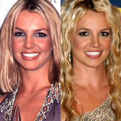 Britney Spears Teeth