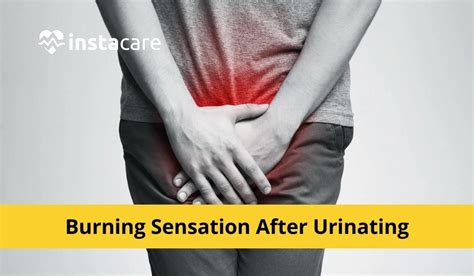 Burning Sensation Urinating