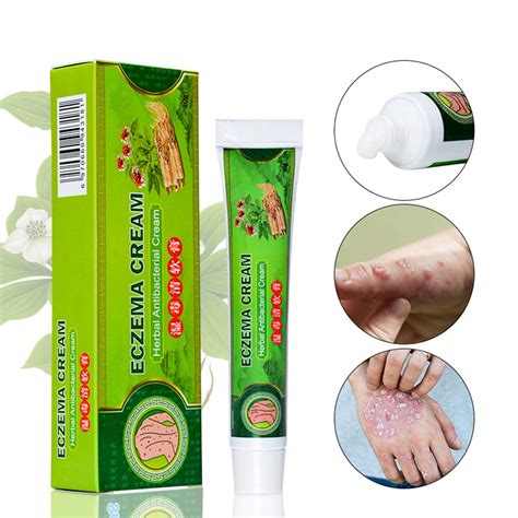 Buy Natural Al Cream Eczema Psoriasis Dermatitis Ointment Al Cream Anti Cream For Itch Skin