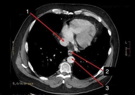 MRAD 3235 Radiographic Applications Of The Abdomen Flashcards Quizlet