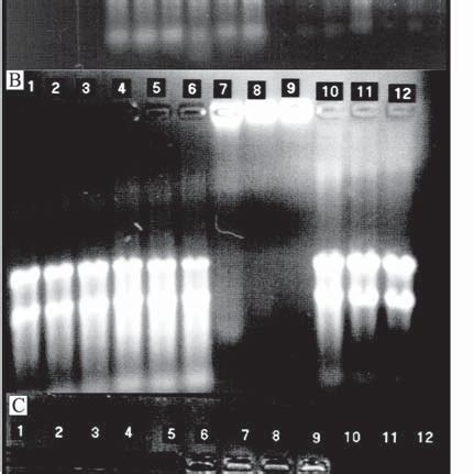 Chemiluminescent photographs from Ruminococcus albus 8 RNA from cells ...