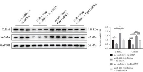 Mir P Affects Cardiac Fibrosis By Targeting Gpd A Three