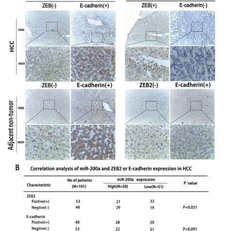 The Correlation Between Mir 200a Expression And Emt A An