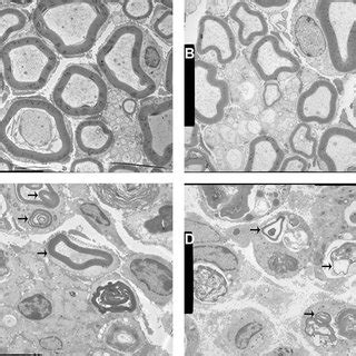 Electron Micrographs Of Nonlesioned And Lesioned Wild Type And