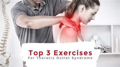 Thoracic Outlet Syndrome Exercises Chart