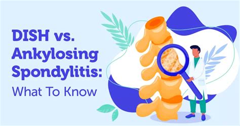 DISH vs. Ankylosing Spondylitis: What To Know | MySpondylitisTeam