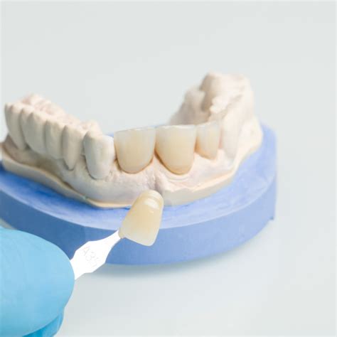 Zirconia Crown Comparison: Bruxzir vs 3M vs Emax Explained - Health