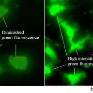 Mitochondrial membrane potential; A) Untreated cell lines indicating ...