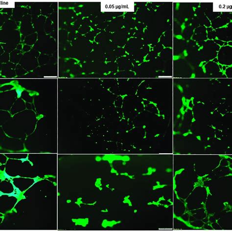 Expression Of Aquaporin AQP Genes In Human Retinal Endothelial Cells