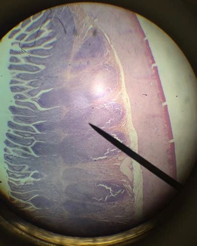 Histology-ileum with Peyer's Patches Flashcards | Quizlet