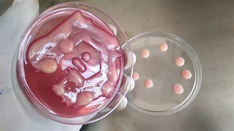 Omg What Dangerous Bacteria Over Growth Of Mucoid Klebsiella On