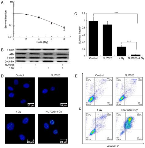 Inhibition Of Dna‑pk Activity Sensitizes A549 Cells To X‑ray