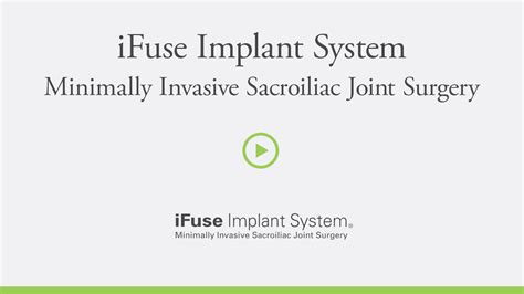 Ifuse The Triangle Shaped Implant Designed Specifically For The Si