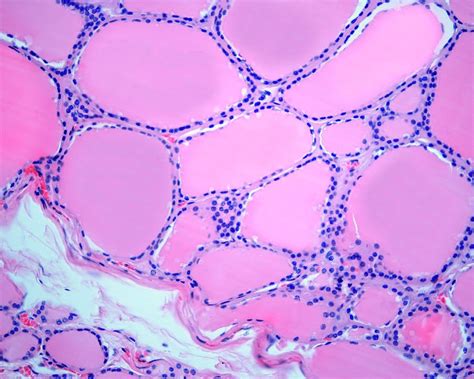 Thyroid Follicle