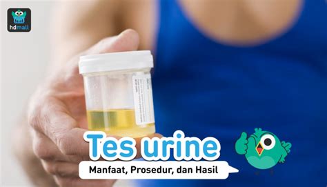 Manfaat Prosedur Dan Hasil Pemeriksaan Tes Urine Hdmall