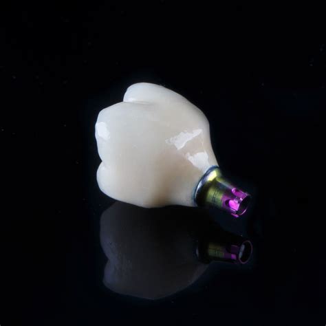 Dental Implants Rockford, IL - Implant Dentistry - Gentle Family Dentistry