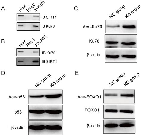 Sirt Physically Interacted With Ku And Deacetylated Ku P And