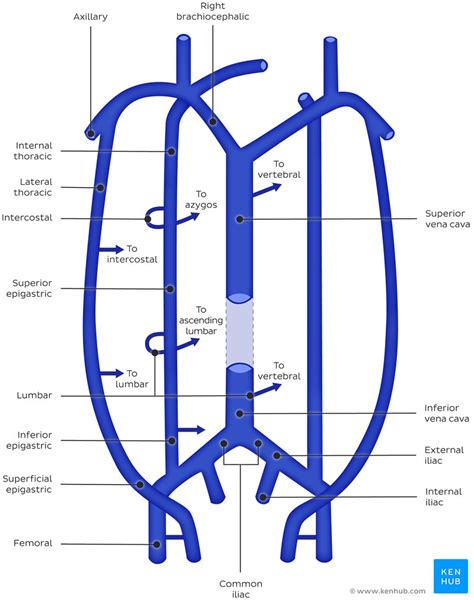 Iliac Vein Compression Syndrome Case With Images Kenhub