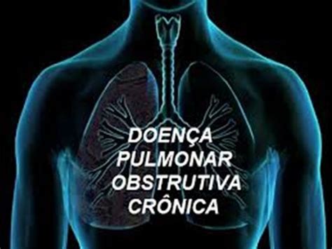 Doença Pulmonar Obstrutiva Crônica Dpoc Hall Medicina E Segurança