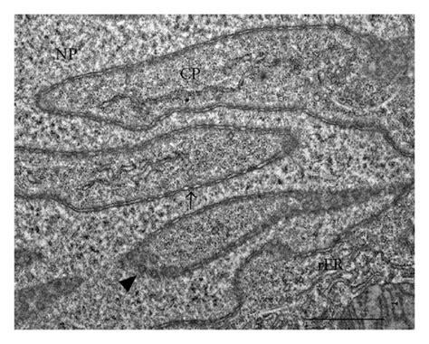 Detail Of Nuclear Envelope Invaginations In Uninfected Midgut Download Scientific Diagram