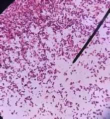 Pathogenic Micro Lab Exam 1 Pictures Quizlet