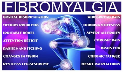 Apa Itu Fibromyalgia Definisi Dan Maknanya Kesihatan Hot Hot Sex Picture