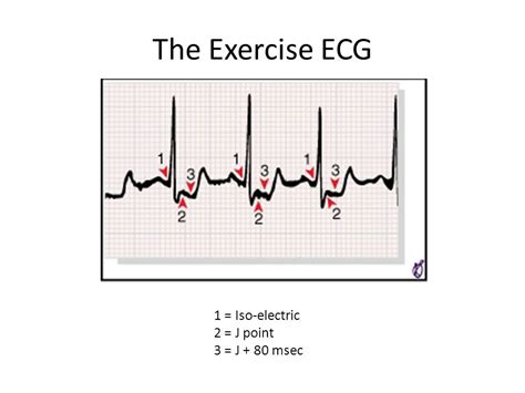 Physiology And Protocol Indications And Contraindications Dn Ppt