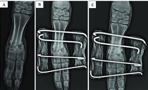 Treatment stages of an infected open distal diaphyseal metacarpus ...