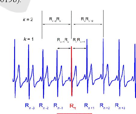 Figure From Generalized Poincar Plots Analysis Of Cardiac Interbeat