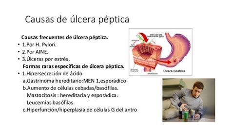 Sindrome de ulcera peptica