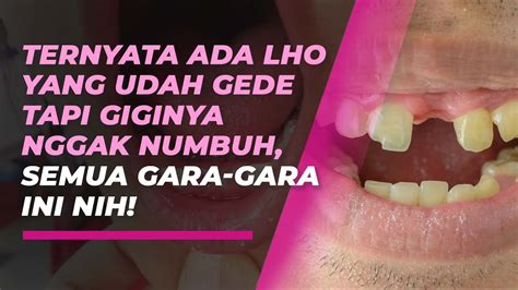 Kenali Anodontia Jenis Kelainan Yang Menyebabkan Gigi Tak Bisa Tumbuh