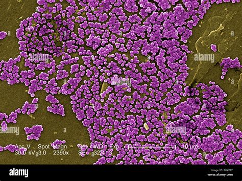 This Colorized Scanning Electron Micrograph Sem Depicted Numerous