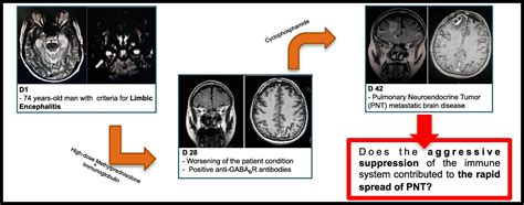 Neuroendocrine Tumour Metastatic Brain Disease During Immunosuppressive Treatment For