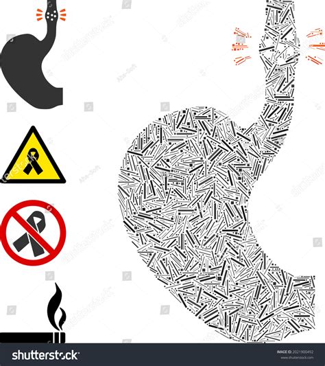 2 Esophageal Narrowing Images, Stock Photos & Vectors | Shutterstock