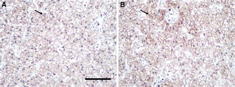 Immunohistochemical Localization Of P Gsk 3β In The Liver Of Large Download Scientific Diagram