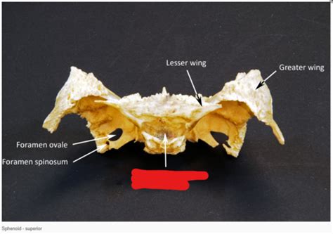 Sphenoid Bone Flashcards Quizlet